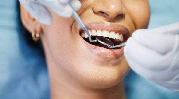 Best Emergency Tooth Extraction in Kirkland, IL